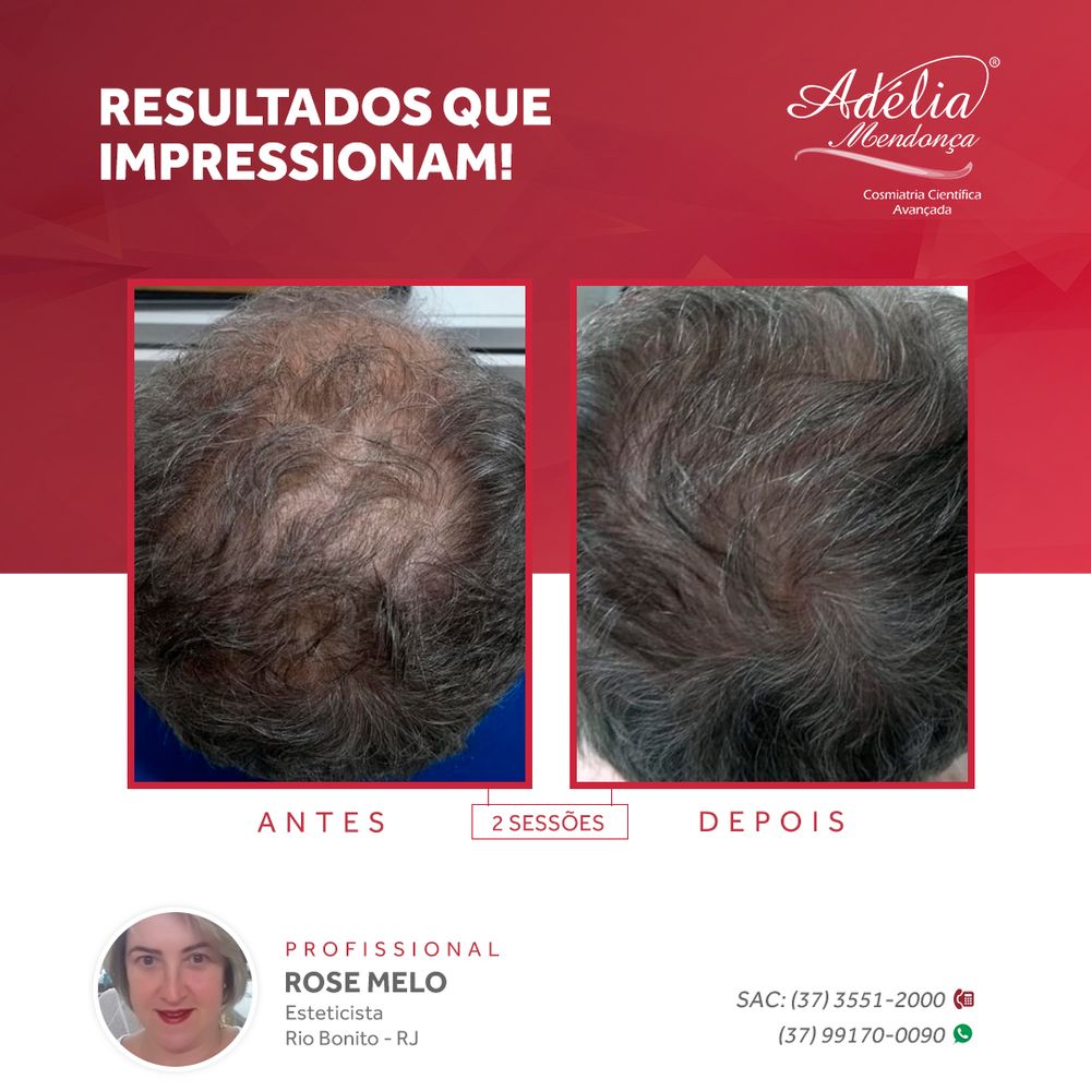 Kit Clinic Hair Booster Adelia Mendonça B2B
